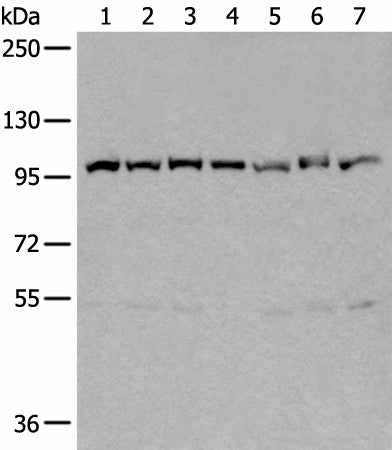 Western blot analysis of 231 Hela A549 A431 HEPG2 Jurkat and K562 cell lysates using VCP Polyclonal Antibody at dilution of 1:400