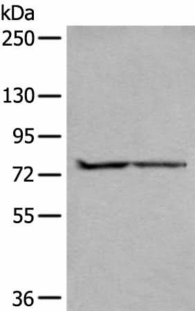 Western blot analysis of A549 and Jurkat cell lysates using ALKBH8 Polyclonal Antibody at dilution of 1:300