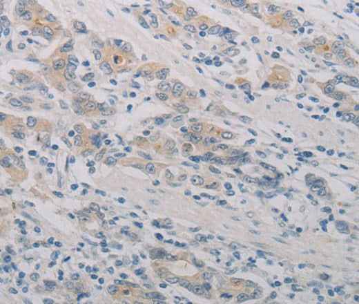 Anti-Human PTAFR Antibody