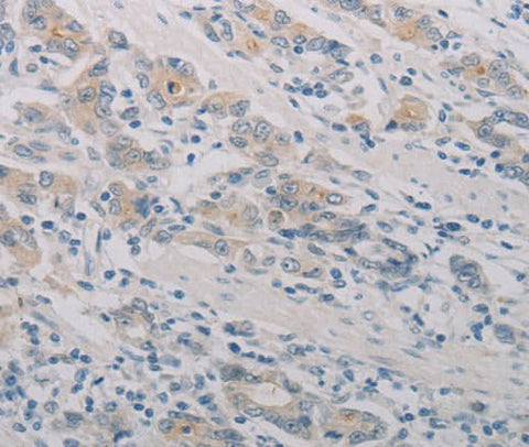 Anti-Human PTAFR Antibody - ABMIUM