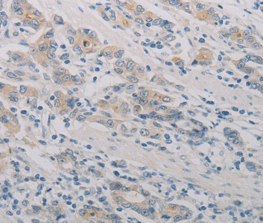 Anti-Human PTAFR Antibody - ABMIUM