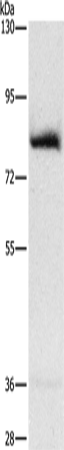 Anti-Human AMPD1 Antibody - ABMIUM