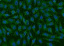 Anti-Human GPX4 Antibody [A933] - ABMIUM