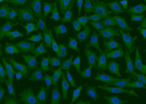Anti-Human GPX4 Antibody [A933] - ABMIUM