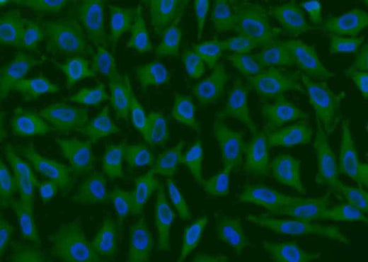 Anti-Human GPX4 Antibody [A933] - ABMIUM