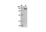 SDS-PAGE analysis of Human TFPI2 proteins, 2 μg/lane of Recombinant Human TFPI2 proteins was resolved with SDS-PAGE under reducing conditions, showing bands at 75 kDa.