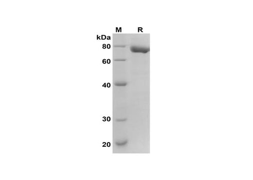 SDS-PAGE analysis of Human TFPI2 proteins, 2 μg/lane of Recombinant Human TFPI2 proteins was resolved with SDS-PAGE under reducing conditions, showing bands at 75 kDa.