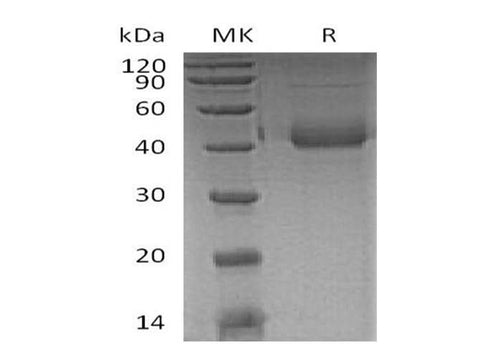Recombinant Human SFTPD/SP-D Protein (Glu22Gly, His Tag) - ABMIUM