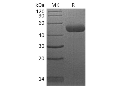 Recombinant Human CTLA4 Protein (mFc Tag) - ABMIUM