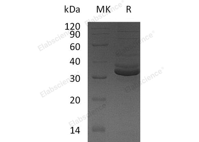 Recombinant Human GPD1/GDP-C Protein (Human Cells, His Tag) - ABMIUM