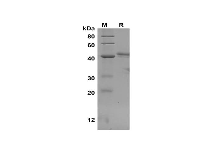 SDS-PAGE analysis of Human IL-17A proteins,2 μg/lane of Recombinant Human IL-17A proteins,was resolved with SDS-PAGE under reducing conditions,showing bands at 42 kDa.