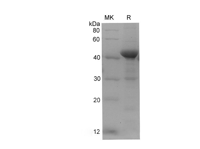 SDS-PAGE analysis of Danio rerio Beta-actin/ACTB proteins, 2 μg/lane of Recombinant Danio rerio Beta-actin/ACTB proteins was resolved with SDS-PAGE under reducing conditions, showing bands at 42-48 kDa.