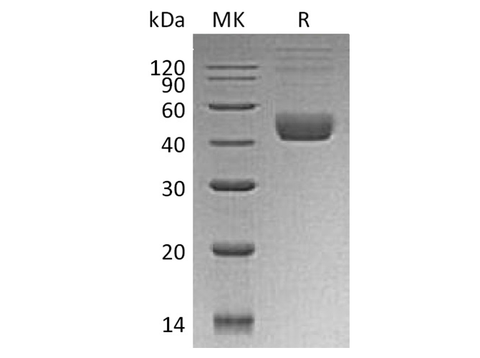 Recombinant Human CTLA4 Protein (GST Tag) - ABMIUM