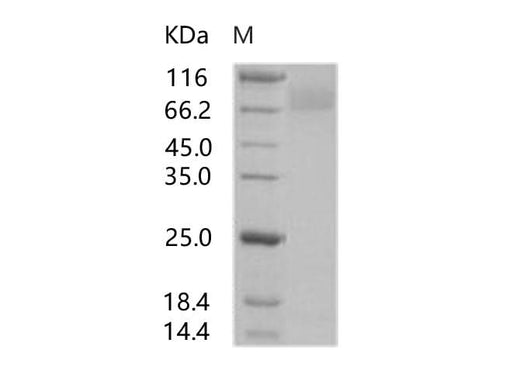 > 85 % as determined by reducing SDS-PAGE.