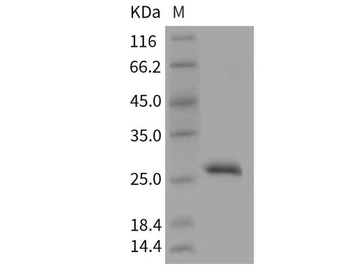 Recombinant Mouse RPE/RPE2-1 Protein (His Tag) - ABMIUM