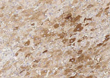 Anti-Human KCNIP3 Antibody [B205]