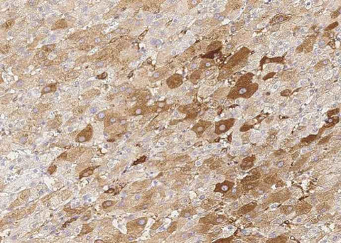 Anti-Human KCNIP3 Antibody [B205] - ABMIUM