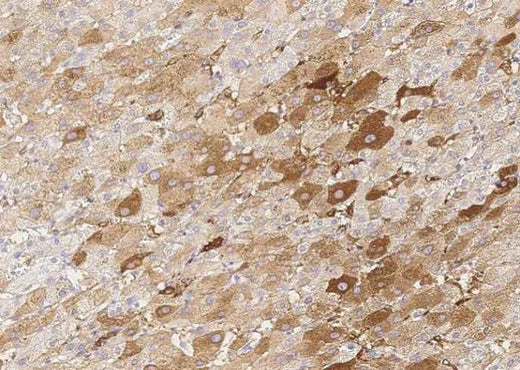 Anti-Human KCNIP3 Antibody [B205] - ABMIUM