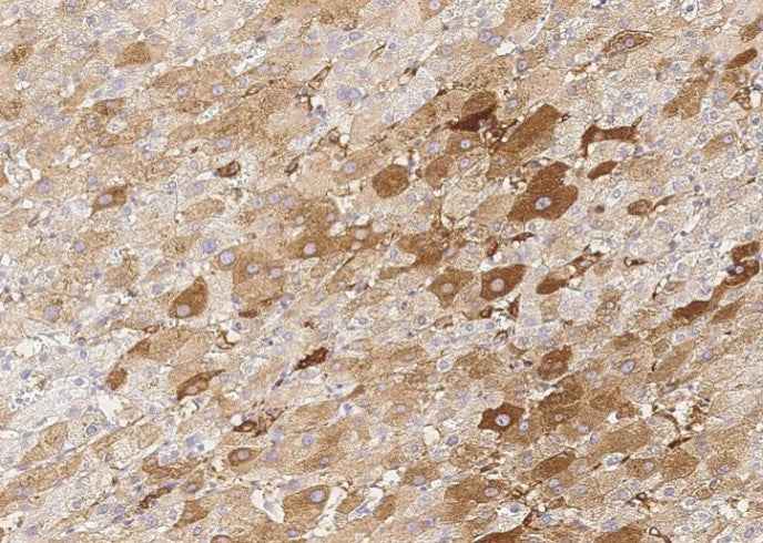 Anti-Human KCNIP3 Antibody [B205]