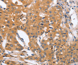 Anti-Human/Mouse/Rat BLNK Antibody - ABMIUM
