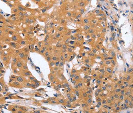 Anti-Human/Mouse/Rat BLNK Antibody