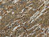 Anti-Human/Mouse/Rat AIF1 Antibody - ABMIUM