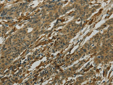 Anti-Human/Mouse/Rat AIF1 Antibody - ABMIUM