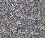 Anti-Human/Mouse CD5L Antibody - ABMIUM