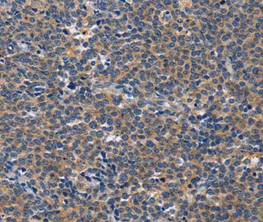 Anti-Human/Mouse CD5L Antibody
