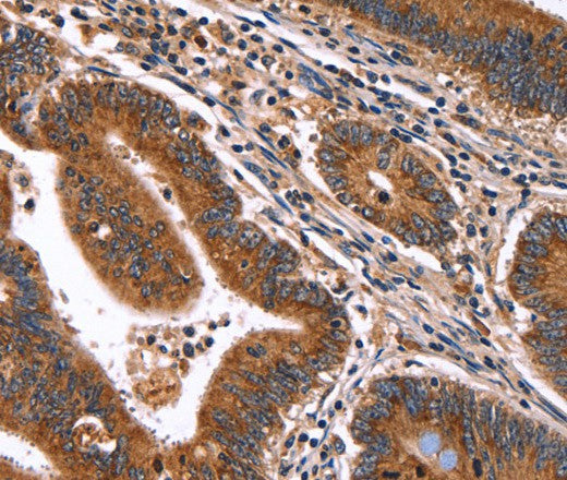 Anti-Human/Mouse/Rat HACE1 Antibody - ABMIUM