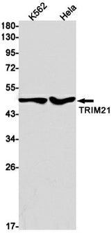 Western blot detection of TRIM21 in K562,Hela cell lysates using TRIM21 Rabbit mAb(1:1000 diluted).Predicted band size:54kDa.Observed band size:50kDa.