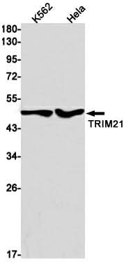 Western blot detection of TRIM21 in K562,Hela cell lysates using TRIM21 Rabbit mAb(1:1000 diluted).Predicted band size:54kDa.Observed band size:50kDa.