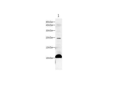 Anti-Human S100A11 Antibody - ABMIUM