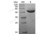 Recombinant Human IDH1 Protein (His Tag) - ABMIUM