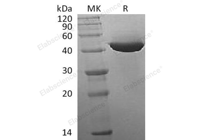 Recombinant Human IDH1 Protein (His Tag) - ABMIUM