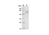 SDS-PAGE analysis of Rat Fas/TNFRSF6/CD95 proteins, 2 μg/lane of Recombinant Rat Fas/TNFRSF6/CD95 proteins was resolved with SDS-PAGE under reducing conditions, showing bands at 50 kDa.