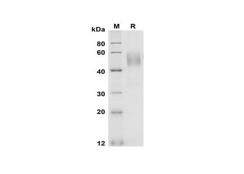 SDS-PAGE analysis of Rat Fas/TNFRSF6/CD95 proteins, 2 μg/lane of Recombinant Rat Fas/TNFRSF6/CD95 proteins was resolved with SDS-PAGE under reducing conditions, showing bands at 50 kDa.