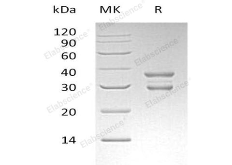 Recombinant Human UBE2J2 Protein (GST Tag) - ABMIUM