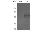 Recombinant Human IL15RA/IL-15RA Protein (Fc Tag) - ABMIUM