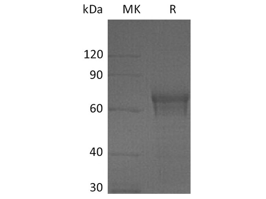 Recombinant Human IL15RA/IL-15RA Protein (Fc Tag) - ABMIUM
