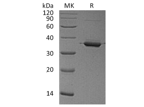 Recombinant Human Annexin A2/ANXA2 Protein - ABMIUM