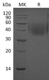 Recombinant Mouse 2B4/CD244 Protein (His Tag) - ABMIUM
