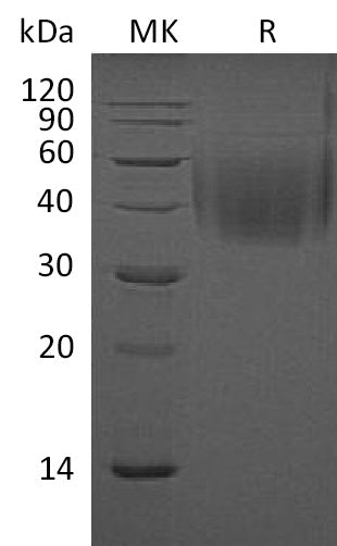 Recombinant Mouse 2B4/CD244 Protein (His Tag) - ABMIUM