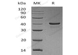 Recombinant Human Resistin Protein (aa 19-108, Fc Tag) - ABMIUM