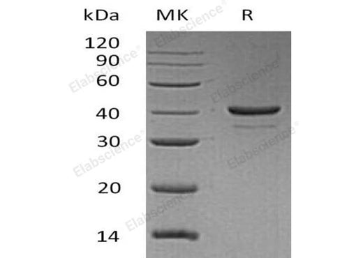 Recombinant Human Resistin Protein (aa 19-108, Fc Tag) - ABMIUM