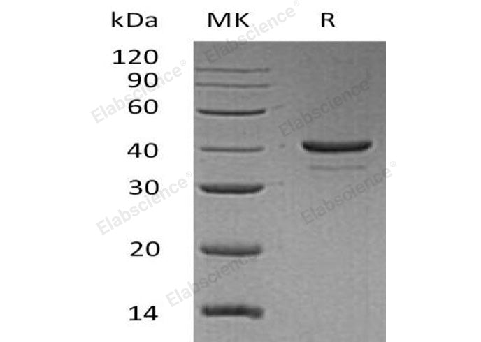 Recombinant Human Resistin Protein (aa 19-108, Fc Tag) - ABMIUM