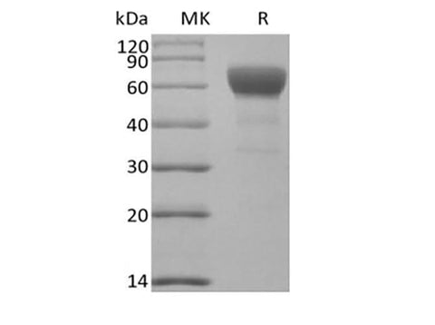 Recombinant Mouse Transforming Growth Factor-Beta Receptor Type II/TGFBR2 (C-Fc) - ABMIUM