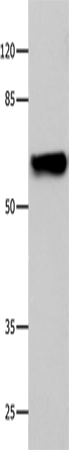 Anti-Human/Mouse/Rat CNGA2 Antibody - ABMIUM