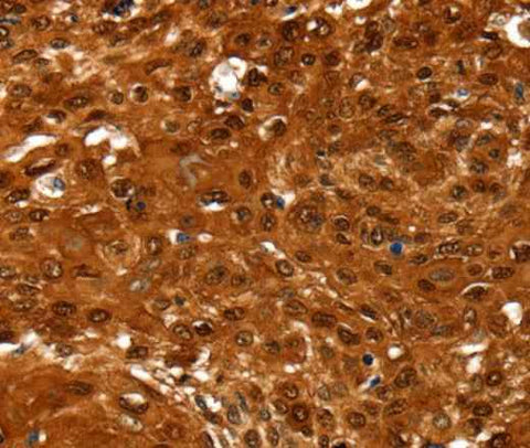 Anti-Human NCOR1 Antibody