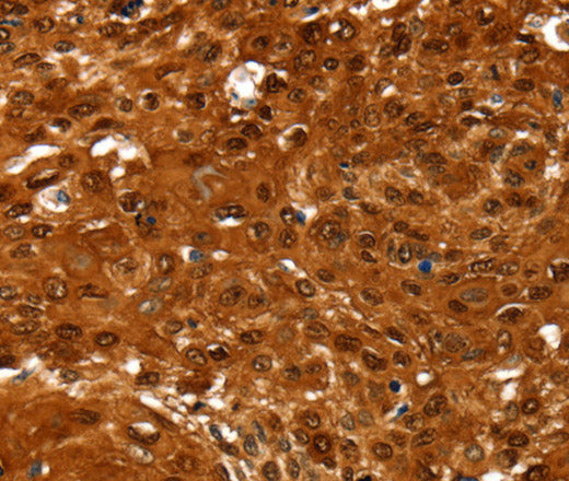 Anti-Human NCOR1 Antibody - ABMIUM